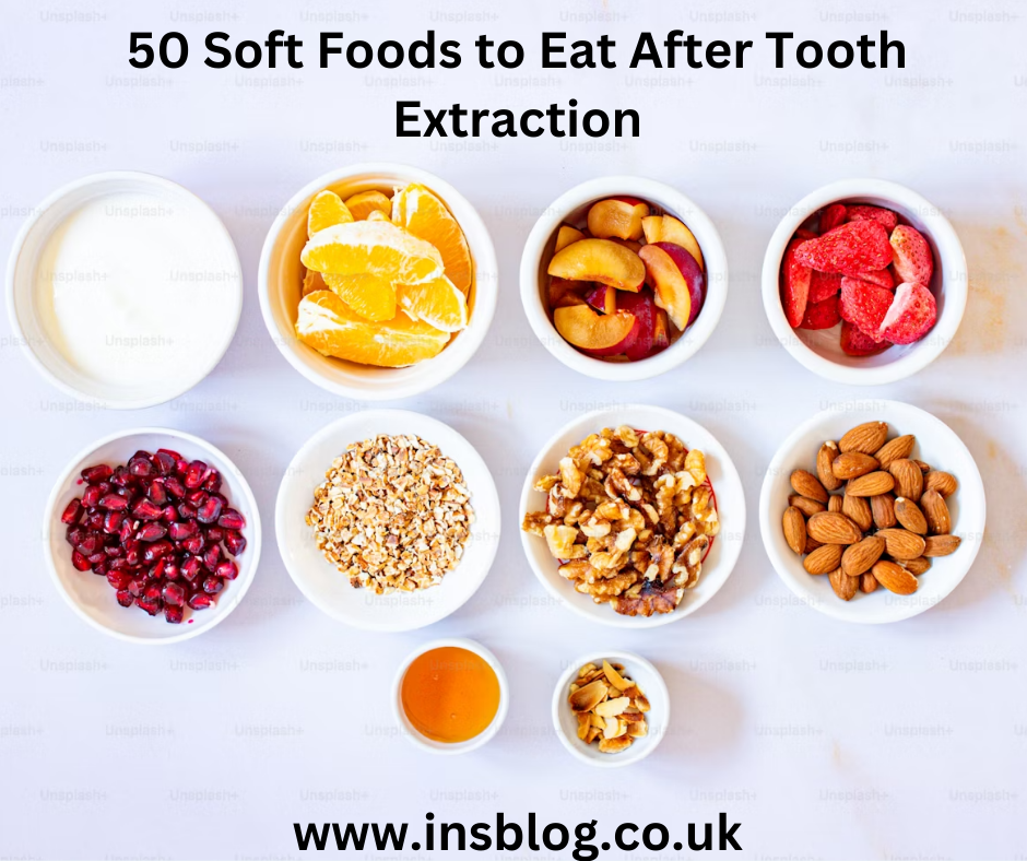 50 Soft Foods to Eat After Tooth Extraction